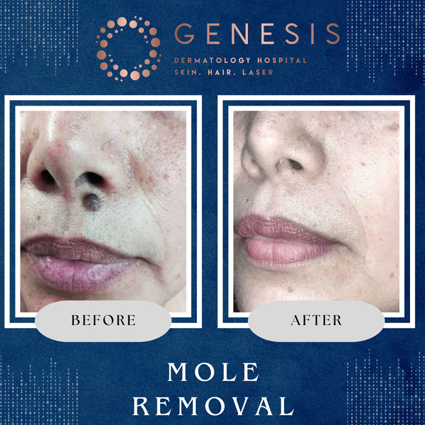 Cover photo of Genesis Dermatgology